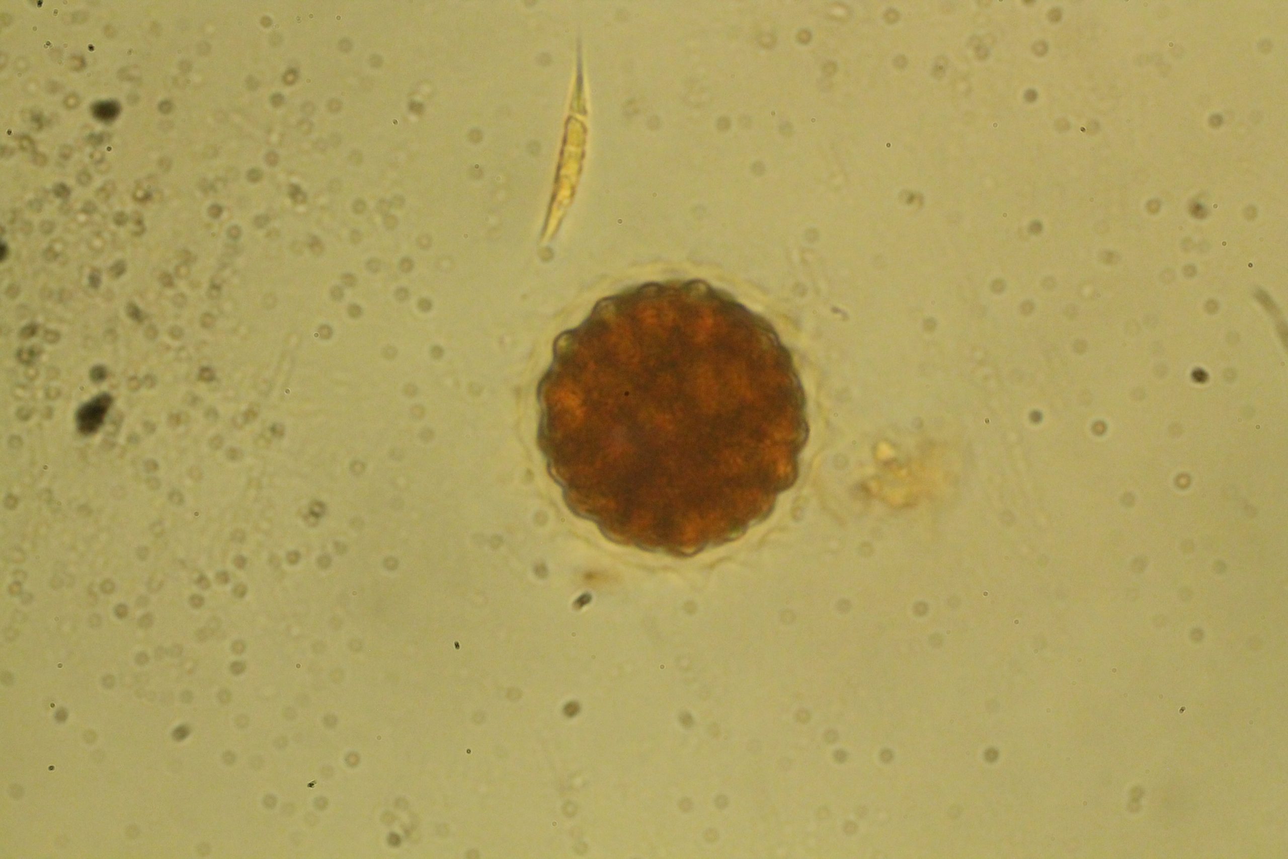 Trochiscia sp scaled