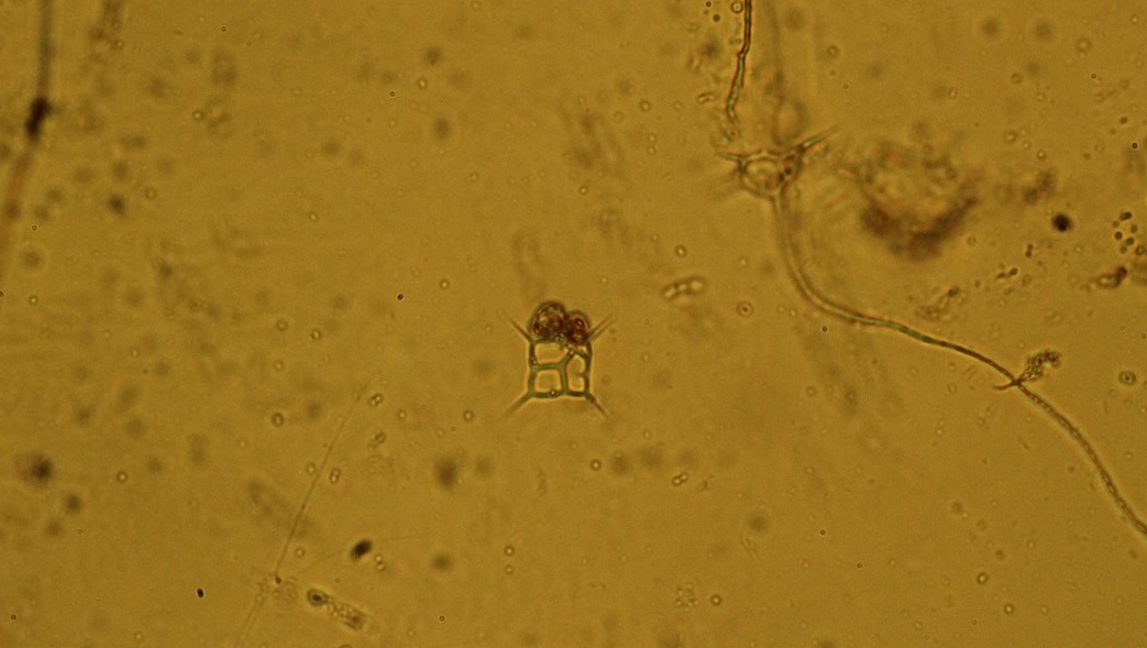 Dictyocha fibula