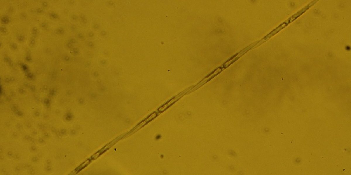 Pseudo nitzschia seriata 1 aspect ratio 1200 600